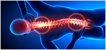 Experienced Slipped Disc Chiropractor in Adelaide